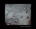 streptococcus pyogenes